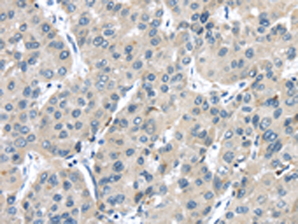 Rabbit Polyclonal Antibody to TRPM2
