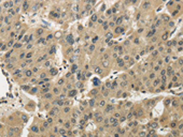 Rabbit Polyclonal Antibody to EIPR1