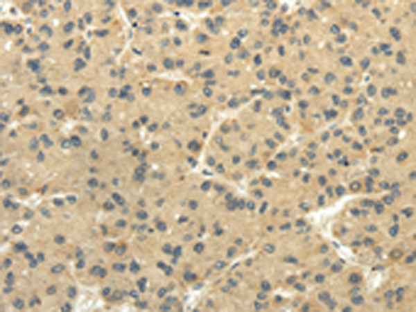 Rabbit Polyclonal Antibody to TULP2