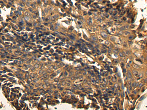 Rabbit Polyclonal Antibody to TUSC2