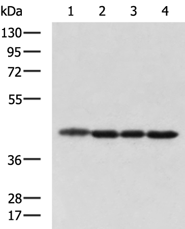 Rabbit Polyclonal Antibody to DNAJB11