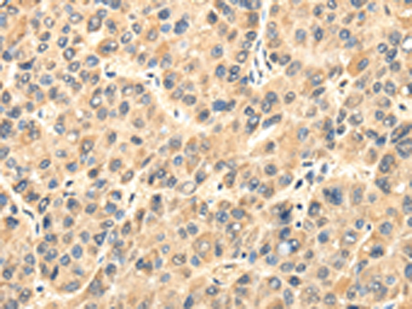 Rabbit Polyclonal Antibody to TWIST2