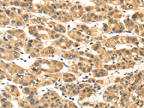 Rabbit Polyclonal Antibody to NME8