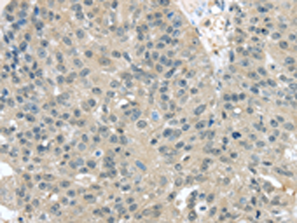 Rabbit Polyclonal Antibody to TXNDC17