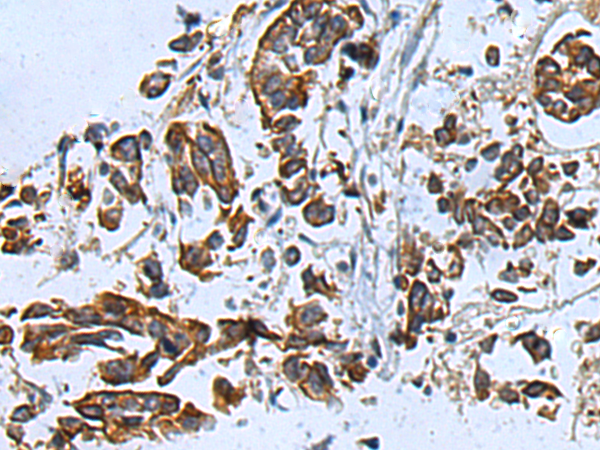 Rabbit Polyclonal Antibody to TYK2