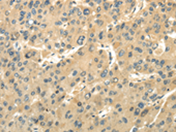 Rabbit Polyclonal Antibody to UBAP1