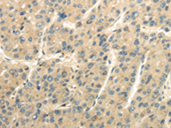 Rabbit Polyclonal Antibody to UBAP2L