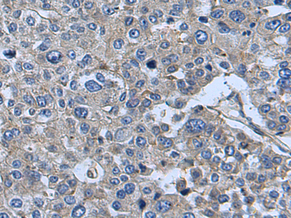Rabbit Polyclonal Antibody to UBA7