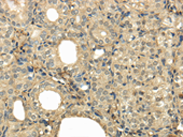 Rabbit Polyclonal Antibody to UBE2B
