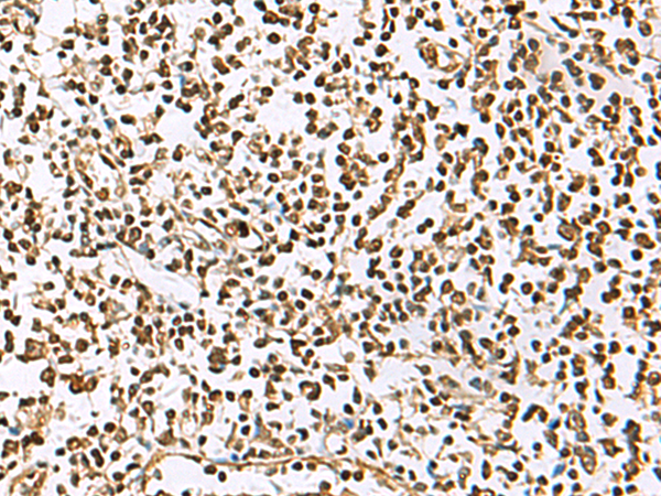 Rabbit Polyclonal Antibody to UBLCP1