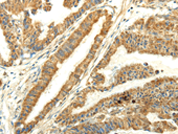 Rabbit Polyclonal Antibody to UBL4B