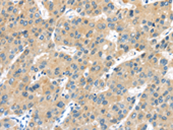 Rabbit Polyclonal Antibody to UBL3