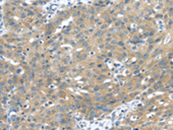 Rabbit Polyclonal Antibody to UCHL3