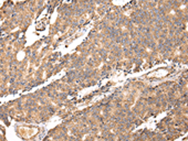 Rabbit Polyclonal Antibody to UGGT2