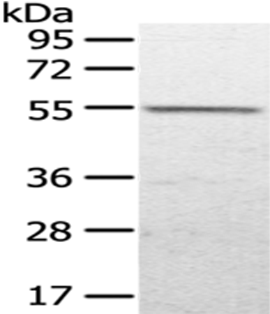 Rabbit Polyclonal Antibody to UGP2