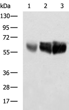 Rabbit Polyclonal Antibody to UGT1A10