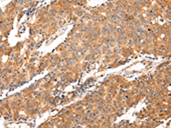 Rabbit Polyclonal Antibody to MAP2
