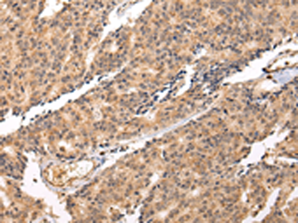Rabbit Polyclonal Antibody to SWAP70
