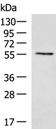 Rabbit Polyclonal Antibody to UGT2B4