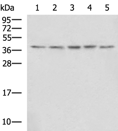 Rabbit Polyclonal Antibody to STRAP