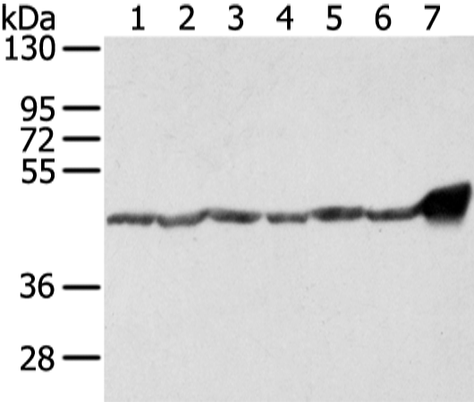 Rabbit Polyclonal Antibody to UQCRC1