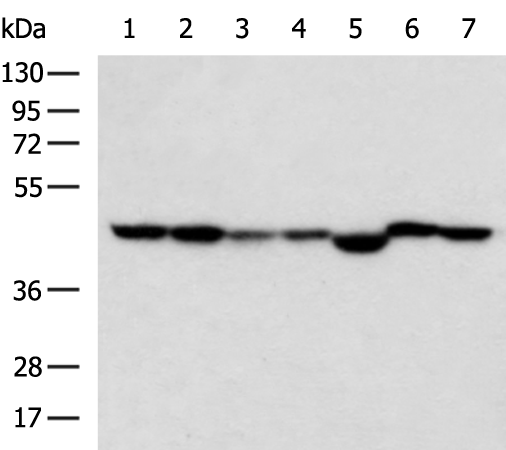 Rabbit Polyclonal Antibody to UQCRC2