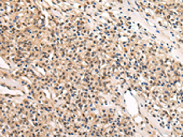 Rabbit Polyclonal Antibody to USF1