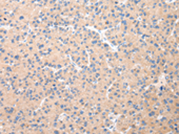 Rabbit Polyclonal Antibody to DUSP11