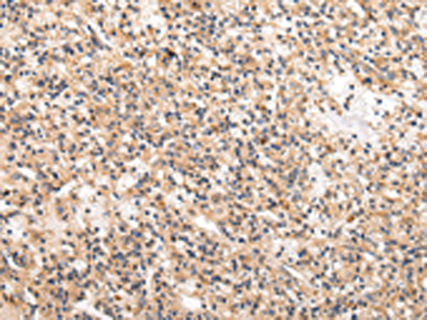 Rabbit Polyclonal Antibody to USP5