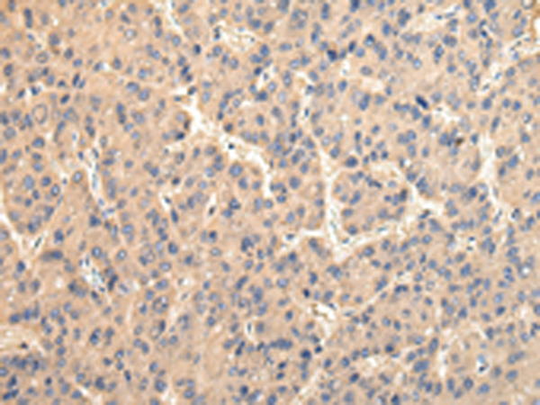 Rabbit Polyclonal Antibody to USP15