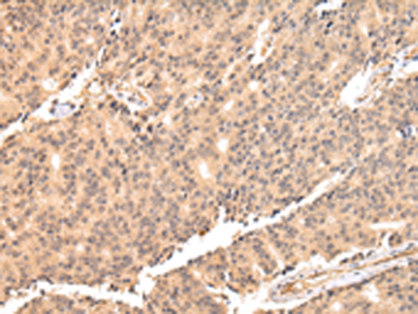 Rabbit Polyclonal Antibody to USP45