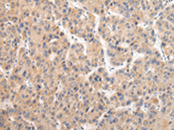 Rabbit Polyclonal Antibody to USP47