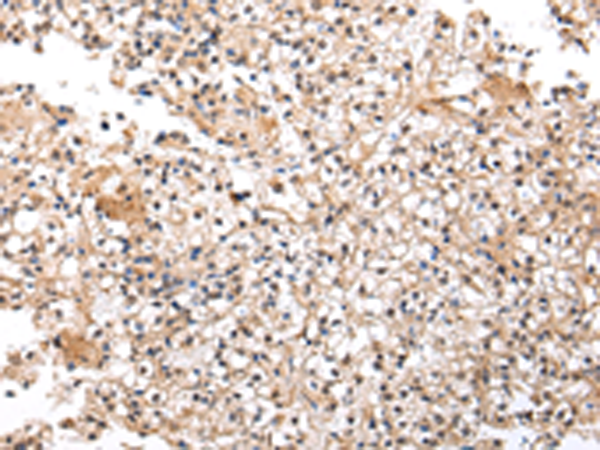 Rabbit Polyclonal Antibody to UXT