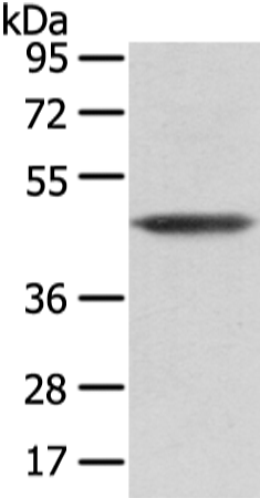 Rabbit Polyclonal Antibody to VASH1