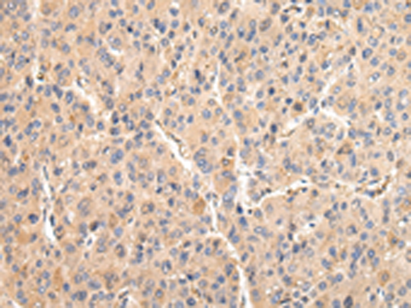 Rabbit Polyclonal Antibody to VCAM1