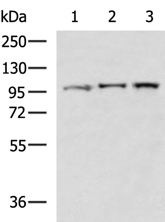 Rabbit Polyclonal Antibody to VIL1
