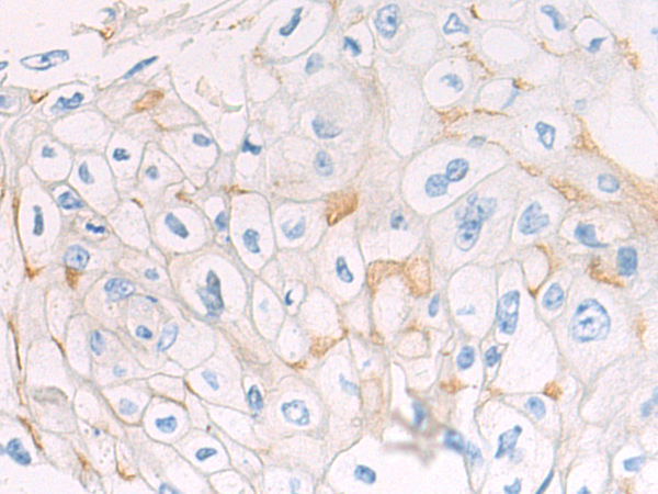 Rabbit Polyclonal Antibody to VIP