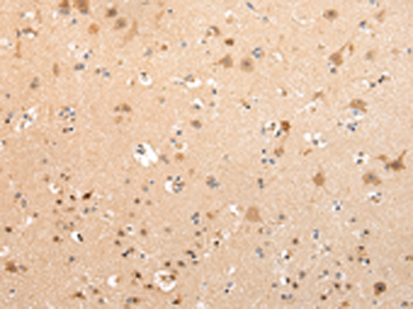 Rabbit Polyclonal Antibody to VPS16