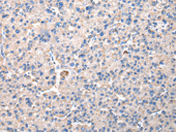 Rabbit Polyclonal Antibody to CHMP3