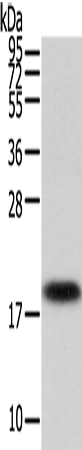 Rabbit Polyclonal Antibody to VPS25