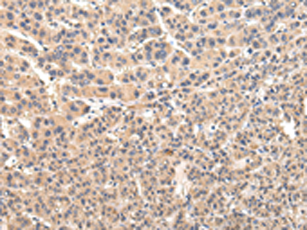 Rabbit Polyclonal Antibody to VPS45