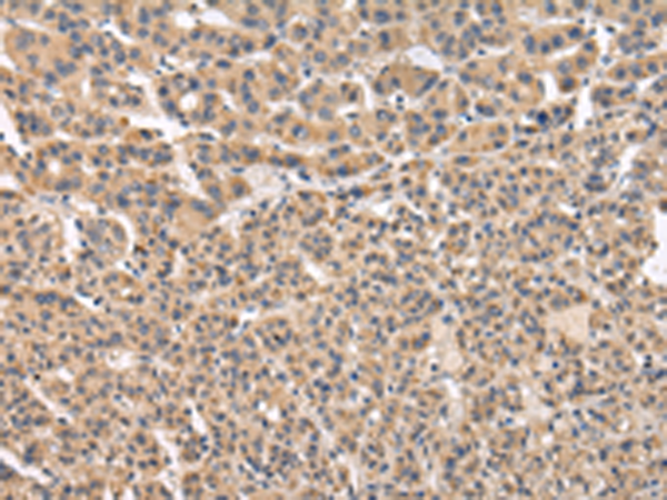 Rabbit Polyclonal Antibody to VPS41