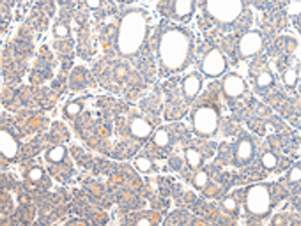 Rabbit Polyclonal Antibody to VPS54
