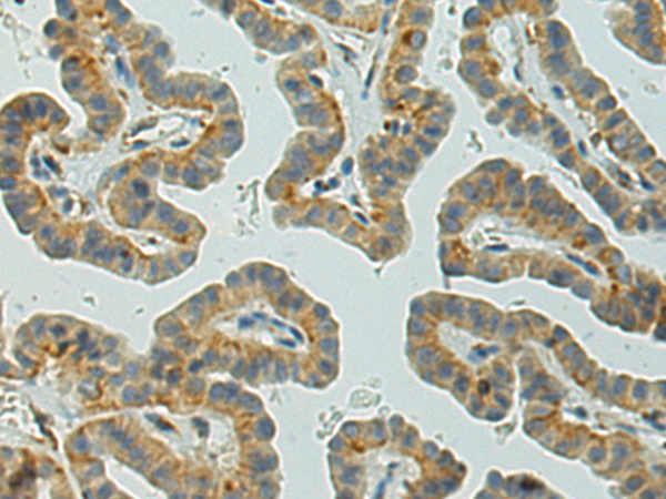 Rabbit Polyclonal Antibody to VPS39