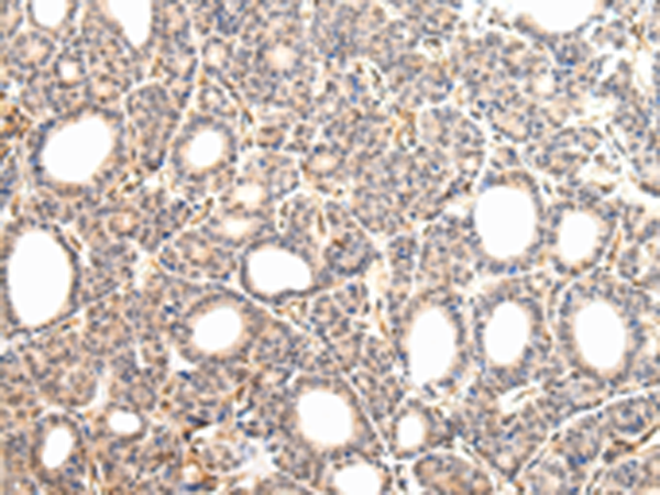 Rabbit Polyclonal Antibody to VPS33A