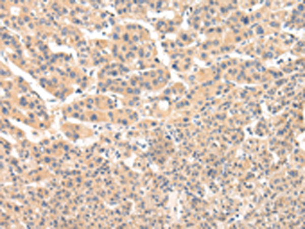 Rabbit Polyclonal Antibody to VPS33B