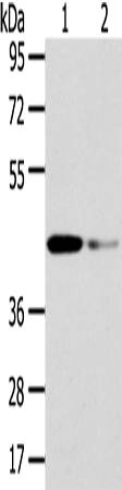 Rabbit Polyclonal Antibody to VPS37A