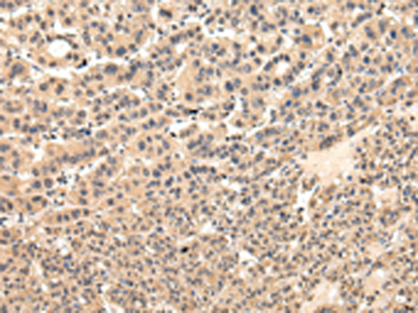 Rabbit Polyclonal Antibody to VPS37D