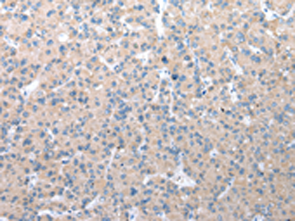 Rabbit Polyclonal Antibody to WDR41