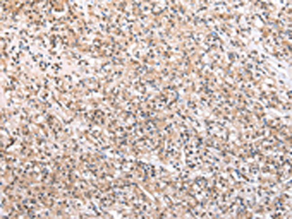 Rabbit Polyclonal Antibody to WDR45